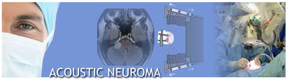Ear Institute of Chicago_Acoustic Neuroma Banner