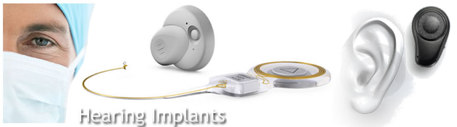 Hearing_Implants_Banner_Ear_Institute_Chicago